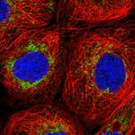 NDUFA8 Polyclonal Antibody