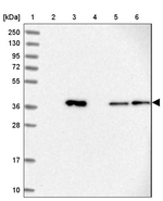ALG2 Antibody in Western Blot (WB)