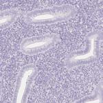SGLT2 Antibody in Immunohistochemistry (Paraffin) (IHC (P))