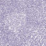 SGLT2 Polyclonal Antibody