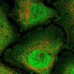 RNF165 Polyclonal Antibody