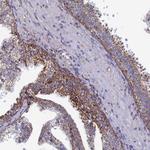 SEC24D Antibody in Immunohistochemistry (Paraffin) (IHC (P))