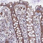 SEC24D Antibody in Immunohistochemistry (Paraffin) (IHC (P))