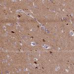 ANO3 Antibody in Immunohistochemistry (IHC)