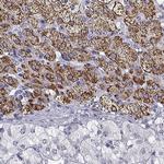 FDX1 Antibody in Immunohistochemistry (IHC)