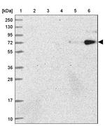 hnRNP UL2 Antibody in Western Blot (WB)