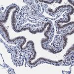 hnRNP UL2 Antibody in Immunohistochemistry (IHC)