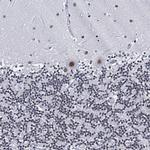 hnRNP UL2 Antibody in Immunohistochemistry (IHC)