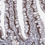 hnRNP UL2 Antibody in Immunohistochemistry (IHC)