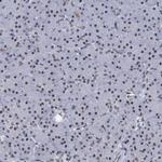 hnRNP UL2 Antibody in Immunohistochemistry (IHC)