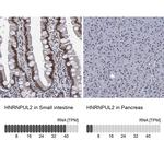 hnRNP UL2 Antibody