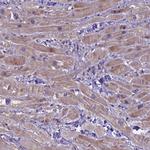 FRY Antibody in Immunohistochemistry (Paraffin) (IHC (P))