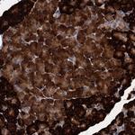 ART5 Polyclonal Antibody