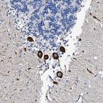 FREM3 Antibody in Immunohistochemistry (Paraffin) (IHC (P))
