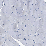 FREM3 Antibody in Immunohistochemistry (Paraffin) (IHC (P))
