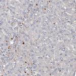DGKA Antibody in Immunohistochemistry (IHC)