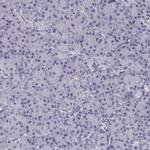 PIT1 Antibody in Immunohistochemistry (IHC)