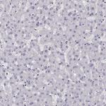 PIT1 Antibody in Immunohistochemistry (IHC)