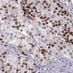 PIT1 Antibody in Immunohistochemistry (IHC)