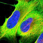 RASAL1 Polyclonal Antibody