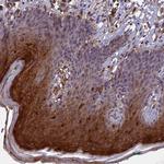 RASAL1 Antibody in Immunohistochemistry (Paraffin) (IHC (P))