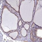 RABGAP1 Polyclonal Antibody