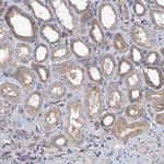 KCC4 Antibody in Immunohistochemistry (IHC)