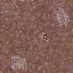 NUBP1 Polyclonal Antibody