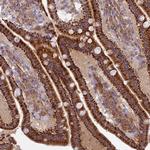 Coronin 7 Polyclonal Antibody