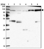 Coronin 7 Antibody in Western Blot (WB)