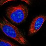 KLHDC4 Polyclonal Antibody