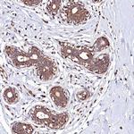 KLHDC4 Antibody in Immunohistochemistry (Paraffin) (IHC (P))