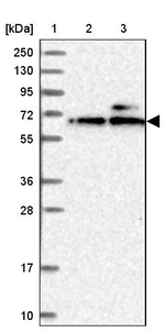 KLHDC4 Antibody in Western Blot (WB)