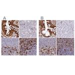 APOB48R Antibody in Immunohistochemistry (IHC)