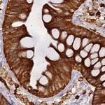 APOB48R Antibody in Immunohistochemistry (IHC)