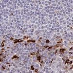 APOB48R Antibody in Immunohistochemistry (IHC)