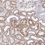 GINM1 Antibody in Immunohistochemistry (Paraffin) (IHC (P))