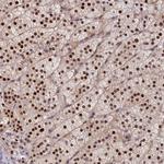 CHST12 Polyclonal Antibody