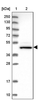 CHST12 Antibody in Western Blot (WB)