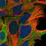 ARMC6 Polyclonal Antibody