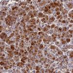 ARMC6 Antibody in Immunohistochemistry (Paraffin) (IHC (P))