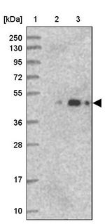 ARMC6 Antibody in Western Blot (WB)