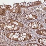 C19orf44 Polyclonal Antibody