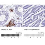 SMIM21 Antibody in Immunohistochemistry (IHC)