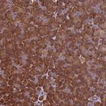 VWA3A Polyclonal Antibody