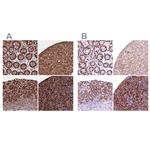 Flavin reductase Antibody in Immunohistochemistry (IHC)