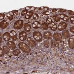 Flavin reductase Antibody in Immunohistochemistry (IHC)