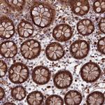 Flavin reductase Antibody in Immunohistochemistry (IHC)