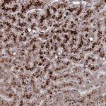 LYPLA3 Antibody in Immunohistochemistry (IHC)