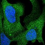 ARHGAP17 Polyclonal Antibody